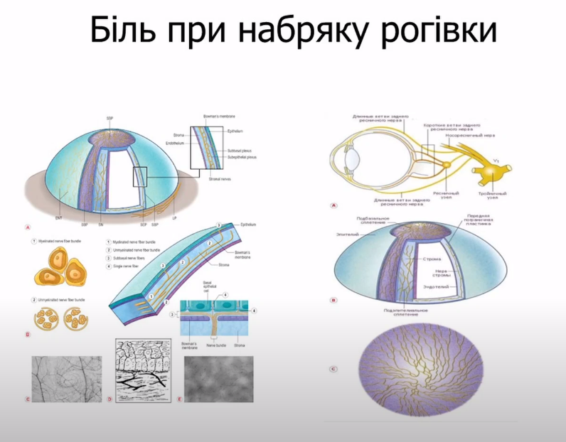 Набряк рогівки: причини та лікування