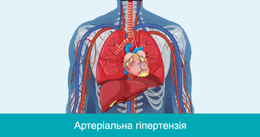 Артеріальна гіпертензія