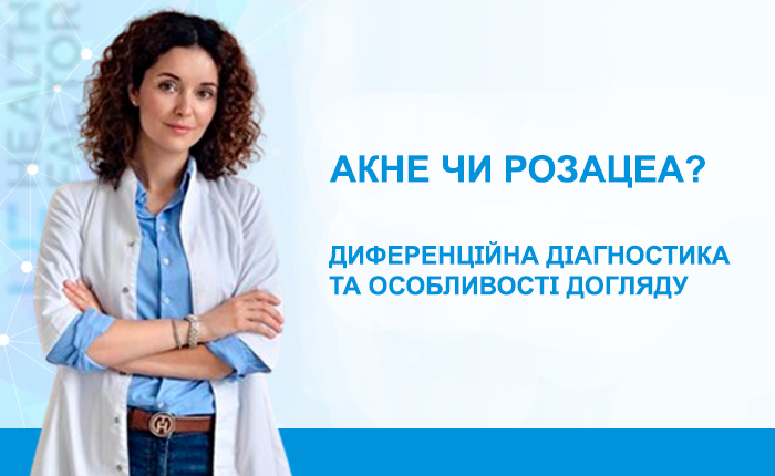 Акне чи розацеа? Диференційна діагностика та особливості догляду